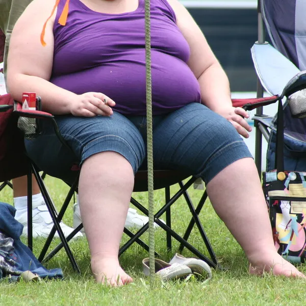 Obesity is a common precursor to and risk factor for type 2 diabetes.